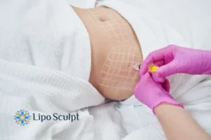 Are The Results From Aqualyx Permanent? 1 Do you want to know how long Aqualyx Tetbury results last?