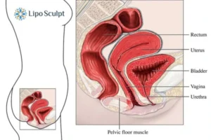 Treatment For A Leaky Bladder 2 How EM Chair treatment Tetbury can help Leaky bladder issues. Read more now!
