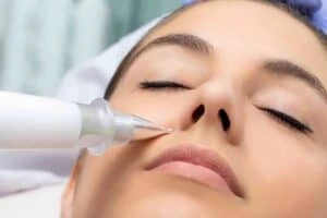 Best Actinic Keratoses Removal 3 Actinic keratoses Tetbury solutions - book in today!
